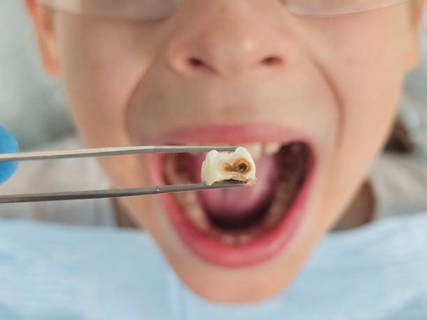 Best Tooth Pain Emergency Relief  in Nevada City, CA